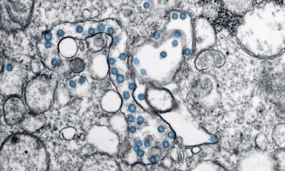 Transmission electron microscopic image of an isolate from the first U.S. case of Covid-19. The spherical viral particles, colorized blue, contain cross-section through the viral genome, seen as black dots.