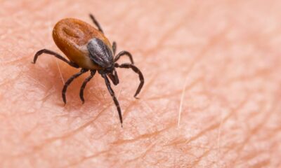 Why the tick season can be worse in the Covid-19 summer