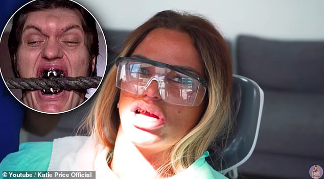 'Just like a villain!': While in the dentist's chair, Katie compared her pre-veneers look to Jaws who appeared The Spy Who Loved Me and Moonraker