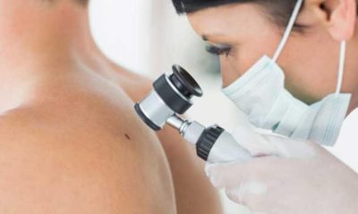 Imagem dermatologista a verificar a pele