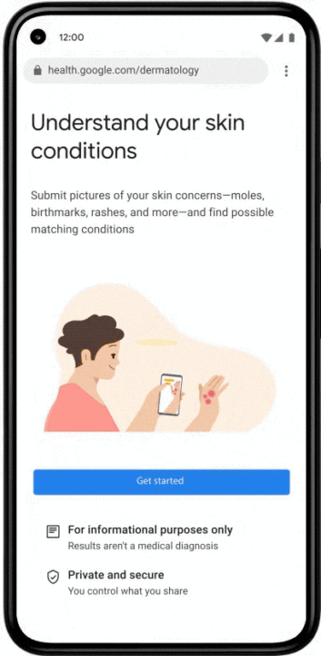 Illustration of a Google application for detecting skin problems