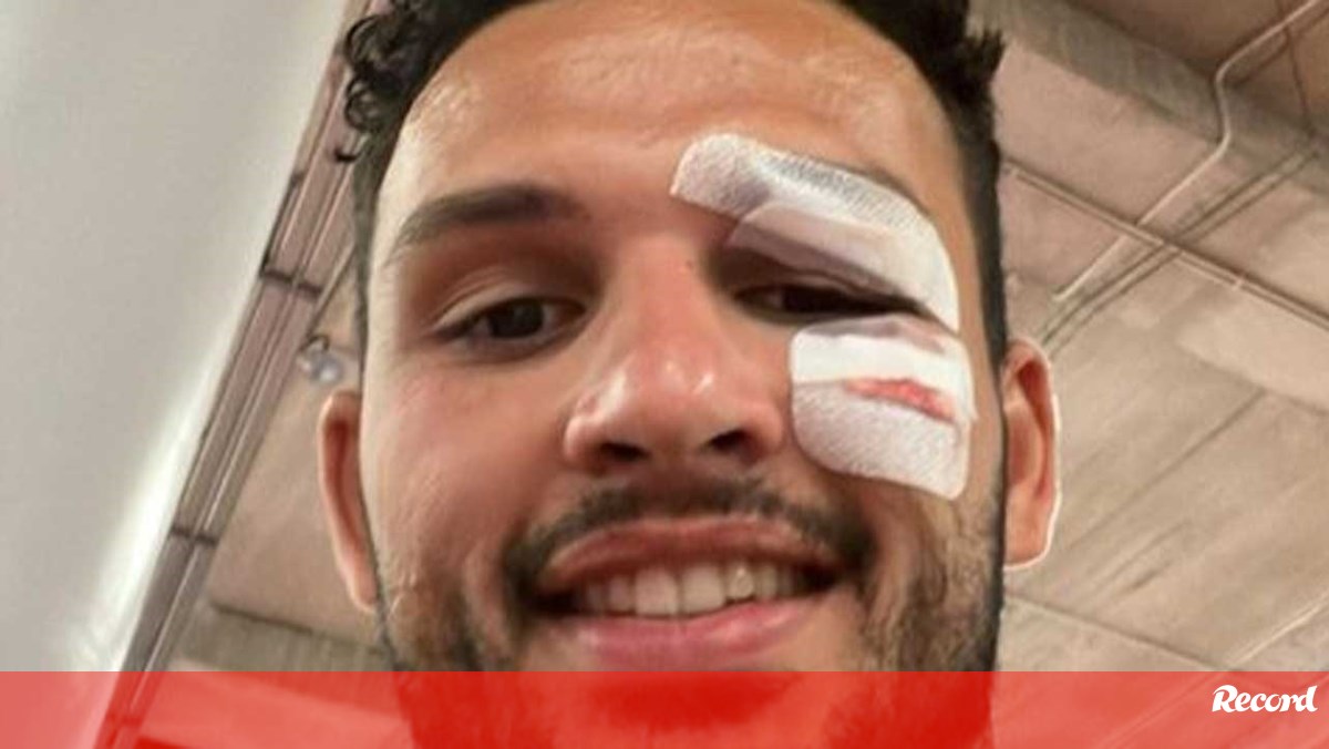 Goncalo Ramos shows how he was after 15 points in the face: "All is well" - Benfica