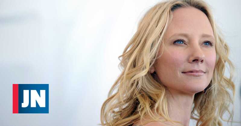 Anne Heche put on life support to make organ donation easier