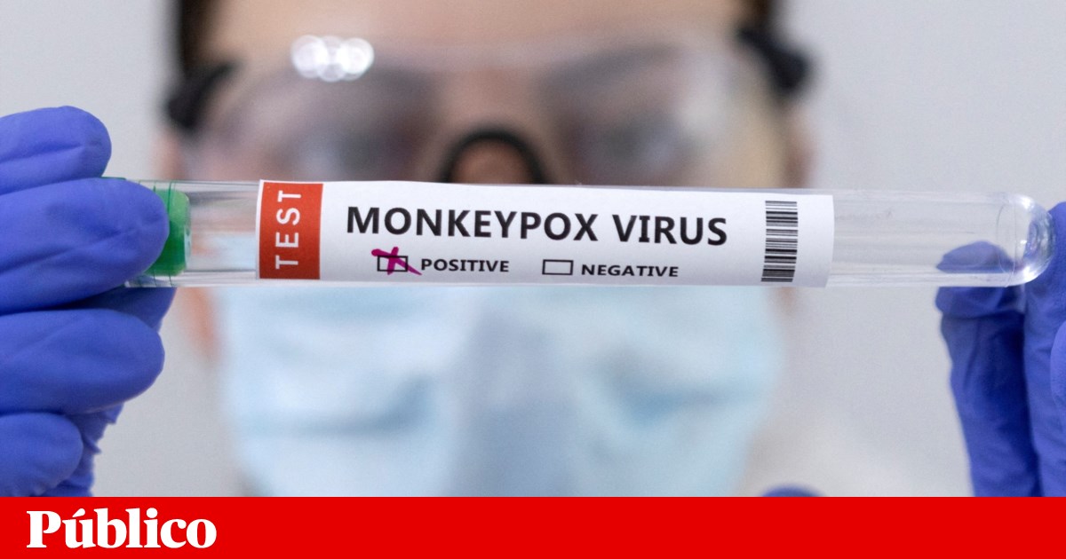 Portuguese tourist - first case of monkeypox in Azores |  monkeypox