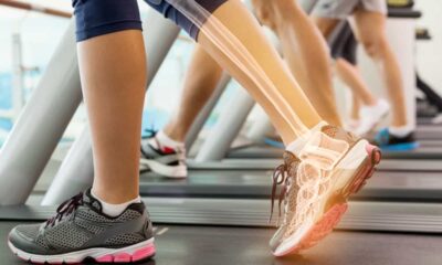 What You Can Do to Improve Bone Density