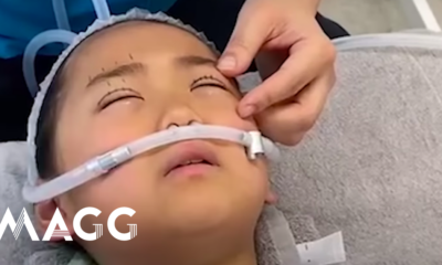 Mom gives 9-year-old daughter plastic surgery of the eyes, "to look beautiful."  The operation lasted 2 hours and was without anesthesia - Actual news