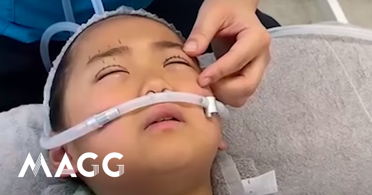 Mom gives 9-year-old daughter plastic surgery of the eyes, "to look beautiful."  The operation lasted 2 hours and was without anesthesia - Actual news